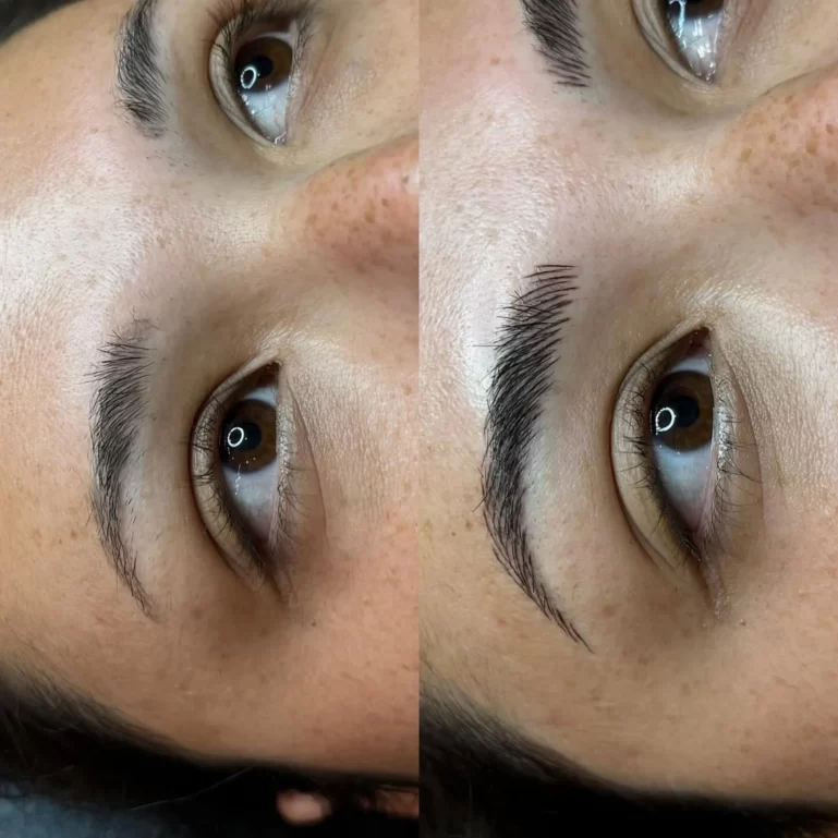 Pigment depth control training